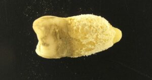 Загадкова Бактерія Століть: Стрептокок з Зуба Мумії Переписує Історію Інфекцій!