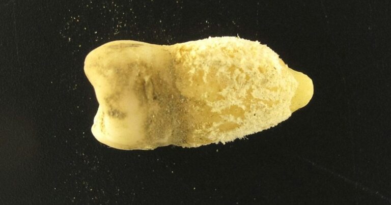 Загадкова Бактерія Століть: Стрептокок з Зуба Мумії Переписує Історію Інфекцій!