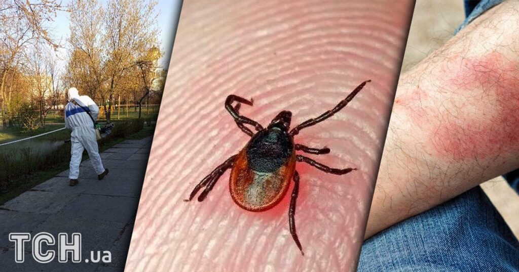 Київ атакує хвороба Лайма: які симптоми і як не допустити менінгіт