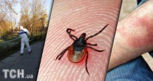 Хвороба Лайма в Києві: як уберегтися від небезпеки та запобігти ускладненням