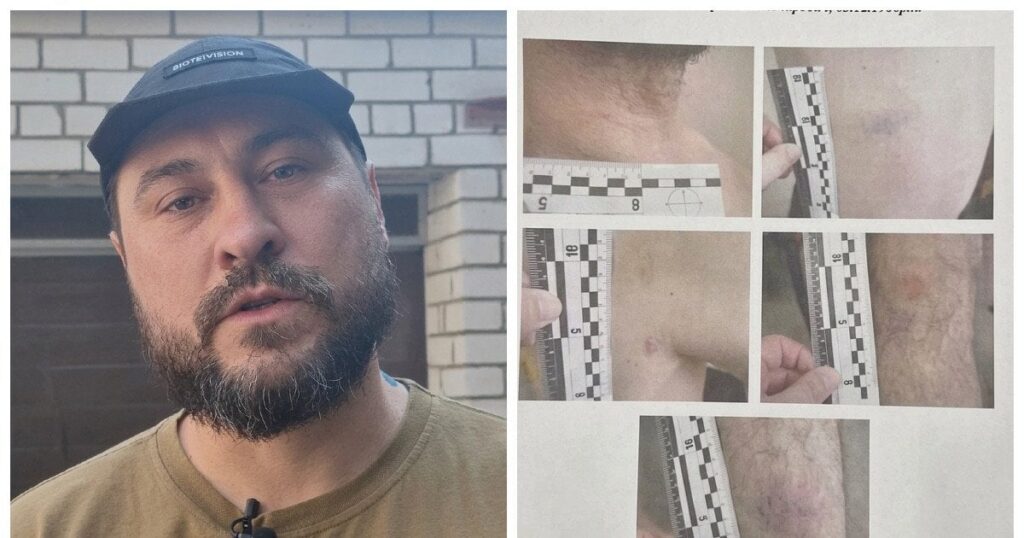 "Я стояв на колінах, і мене пи*дили": у Дніпрі побили ветерана, у ТЦК відповіли і заявили про вимагання грошей (відео)