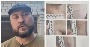 "Я стояв на колінах, і мене пи*дили": у Дніпрі побили ветерана, у ТЦК відповіли і заявили про вимагання грошей (відео)