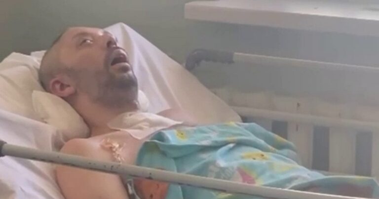 Шокуючий інцидент у Дніпрі: Чоловік у комі після зустрічі з ТЦК – Лубінець розкриває деталі