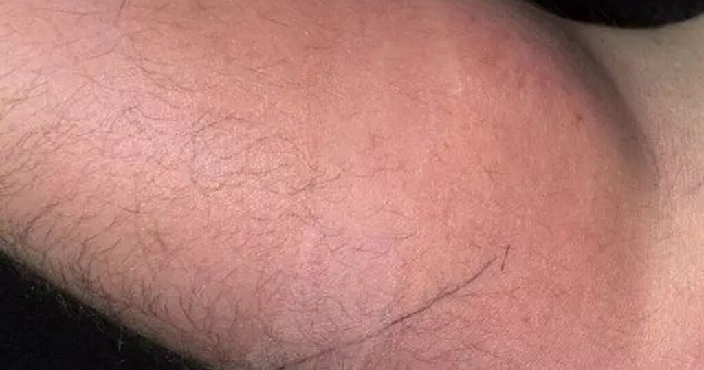 Хотів вилікувати спину власною спермою: дивний експеримент чоловіка закінчився лікарнею Хотів вилікувати спину власною спермою: дивний експеримент чоловіка закінчився лікарнею
