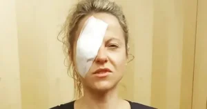 Мерехтіння світла та головний біль: жінка дізналася страшну причину симптомів — Світ