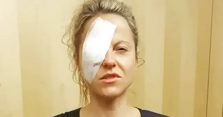 Мерехтіння світла та головний біль: Як рідкісна онкологія змінила життя британки