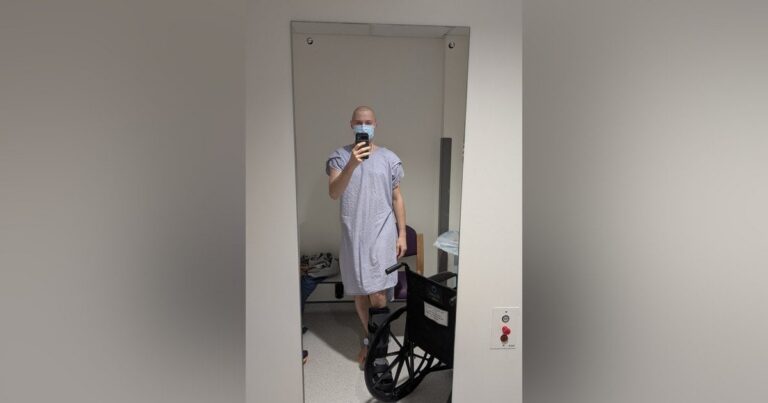 22-річний спортсмен втратив ногу через рак кістки: як небезпечний біль у щиколотці став симптомом онкології